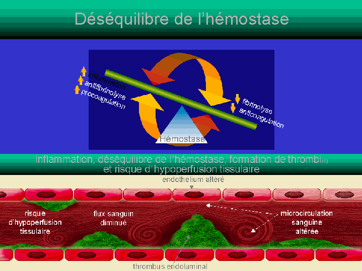 Physiopathologie de la CIVD des défaillances viscérales